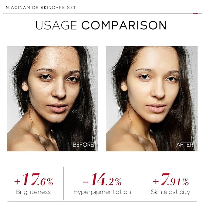 skin care set - skincare set for women - facial skin care sets & kits - gift set skincare - skin care sets for teens- skin care sets for men (ceramide)