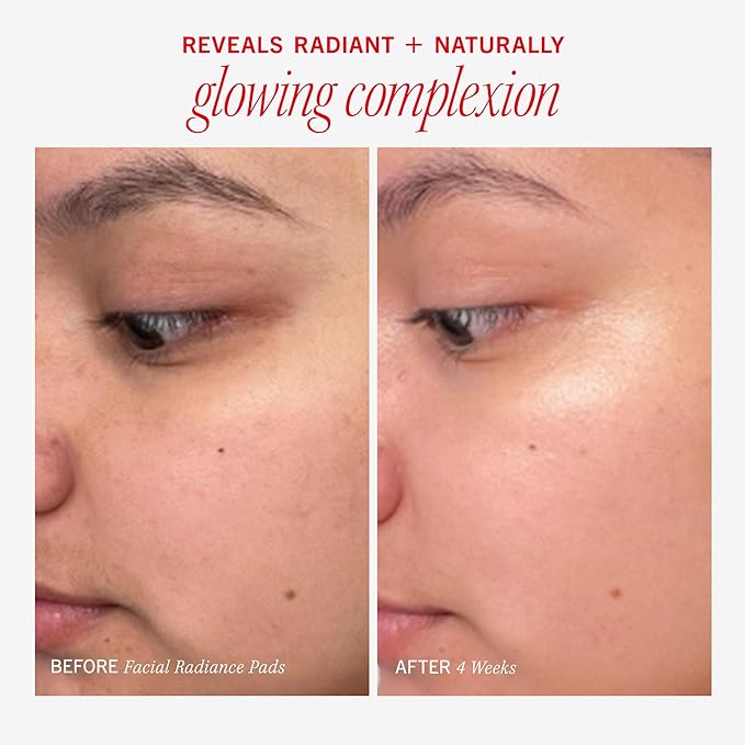 First Aid Beauty - Facial Radiance Pads with Glycolic & Lactic acids, Daily Exfoliating pads with AHA to Help Tone & Brighten Skin, One Step Makeup Prep, Compostable for Daily Use, 28 Pads, 3 ct