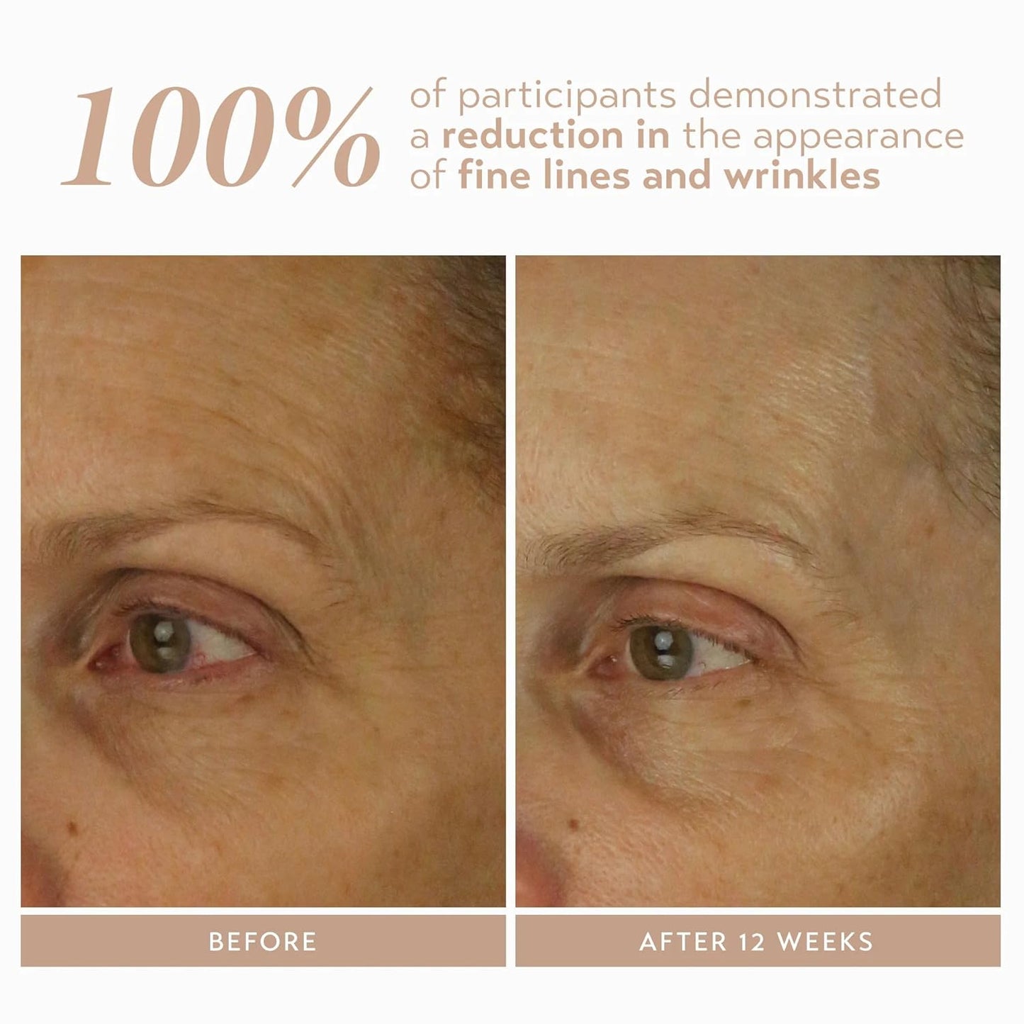 SHANI DARDEN SKIN CARE Retinol Reform with 1% Encapsulated Retinol Serum for Face & Neck, Gentle Slow-Release Face Serum with Tripeptide for Wrinkles, Fine Lines & Uneven Tone, 1 fl oz