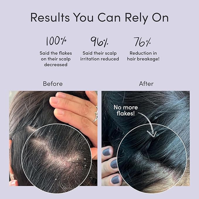 Jupiter Oil Control Exfoliation Set, Anti-Dandruff Shampoo, Conditioner, Restoring Serum, Purifying Mask, & Daily Scalp Essential, Physician-Formulated for Flaky, Itchy, Oily, & Dry Scalp