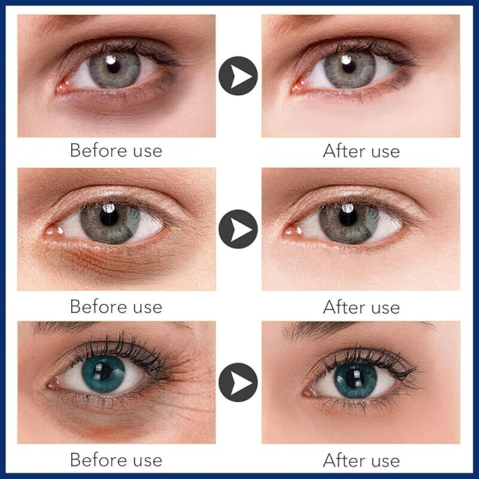 Under Eye Cream for Dark Circles and Fine Lines, Repair Eye Cream for Lifting Firming and Anti-Wrinkle, Anti Age Eye Care Product