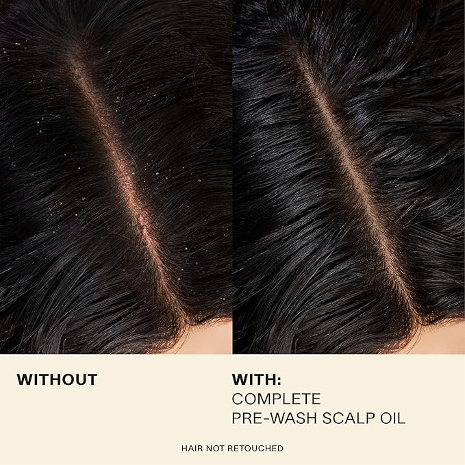 JVN Pre-Wash Scalp Oil & Hair Treatment Oil, Pre Shampoo Dry Scalp Treatment, Scalp Cleansing Oil for All Hair Types, Sulfate Free (1.7 Fl Oz)