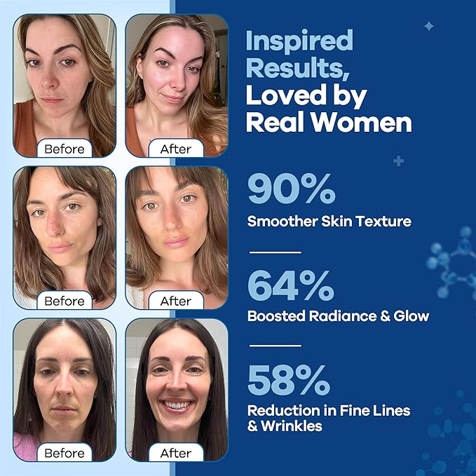 TURMSKIN® Hyaluronic Acid Serum Ampoules [ULTRA HYDRATING VIALS] - 3% Hyaluron Booster for Glass Skin & Anti Aging - 24 Hours Hydration - Soft PE Triple Hyaluronic Complex for Faceskin Repair & Renew