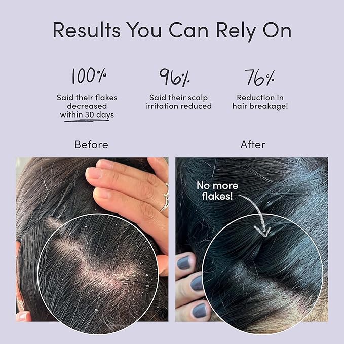 Jupiter Oil Control & Exfoliation Set, Anti-Dandruff Shampoo, Conditioner, Restoring Serum, Scalp Brush, & Purifying Mask, for Women & Men, Dermatologist-Formulated for Flaky, Itchy, Oily, & Dry Scalp