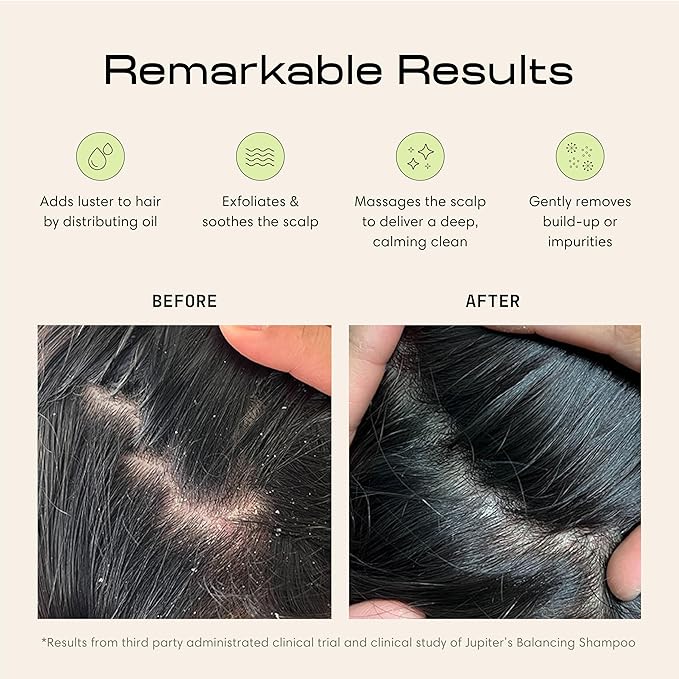 Jupiter Exfoliator Brush For Removing Dandruff & Build-Up - Detangling Scrubber For Wet or Dry Hair - Supports Circulation & Growth - For All Hair Types - Black, 2 Pack