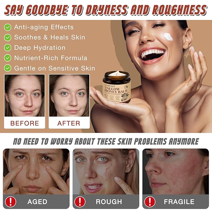 Beef Tallow for Skin,Tallow and Honey Balm,Beef Tallow for Face,Tallow Face Moisturizer,Natural Moisturizer Hydrates,Deeply Nourishes the Skin, Enhances Natural Radiance (1pcs)