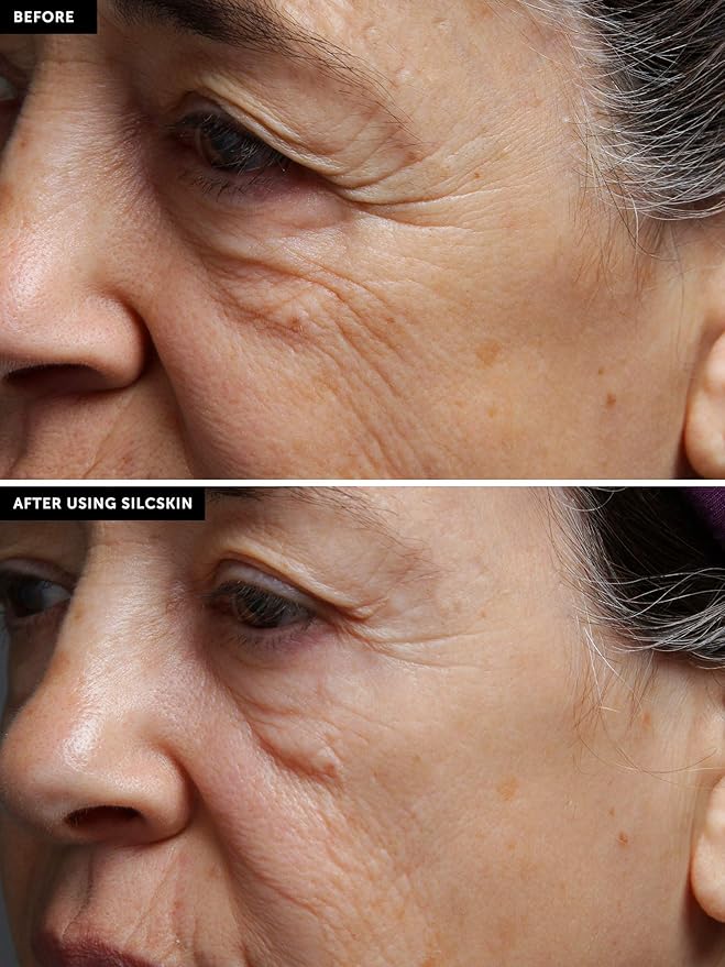 SilcSkin Full Face Set, Helps with Face & Brow Wrinkles from Sun Aging Side Sleeping, Reusable Self Adhesive Medical Grade Silicone, 1 Brow Pad, 4 Eye Pads, 2 Multi-Area Pads - 45 Day Supply