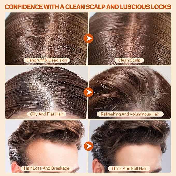 Scalp Scrub, Pumpkin Seed Oil Scalp Exfoliator With Biotin & Rosemary, Sulfate Free Scalp Detox for Itchy Scalp & Dandruff & Buildup Removal & Hair Growth, Hair Scrub with Scrubber