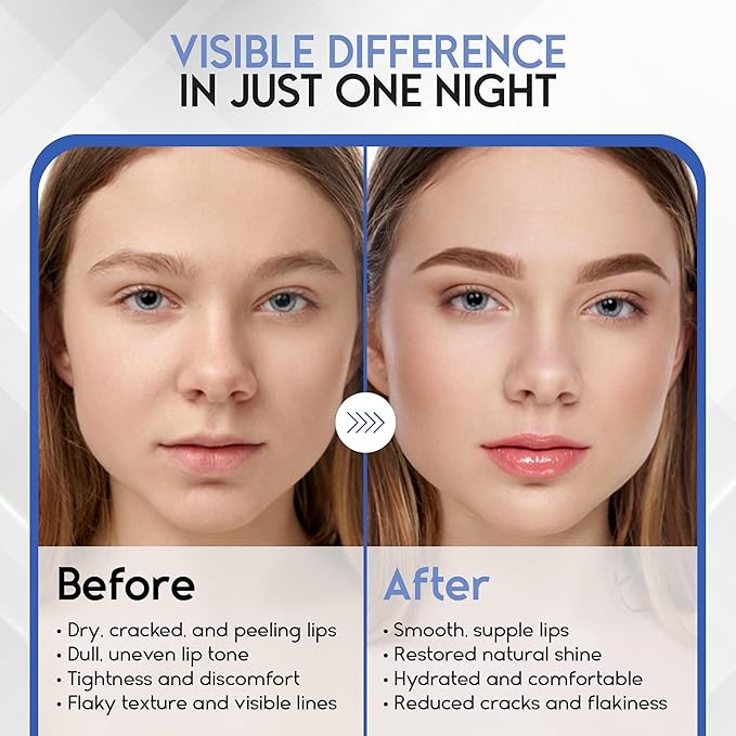 Lip Mask Overnight with Hyaluronic Acid & Collagen, Lip Sleeping Mask for Dry Cracked Lips, Moisturizing, Hydrating, Exfoliating Night Treatment for Lip Care (Berry)