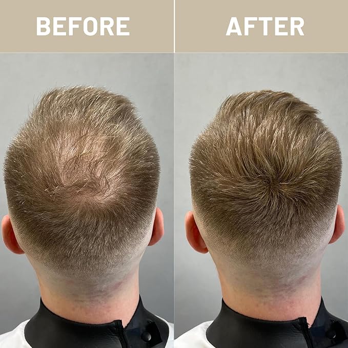 VOLLUCK Hair Fibers for Thinning Hair, Instant Coverage Hair Building Fibers for Women and men, Natural Hair Powder for Conceal Hair Loss 28 g (Light Brown)