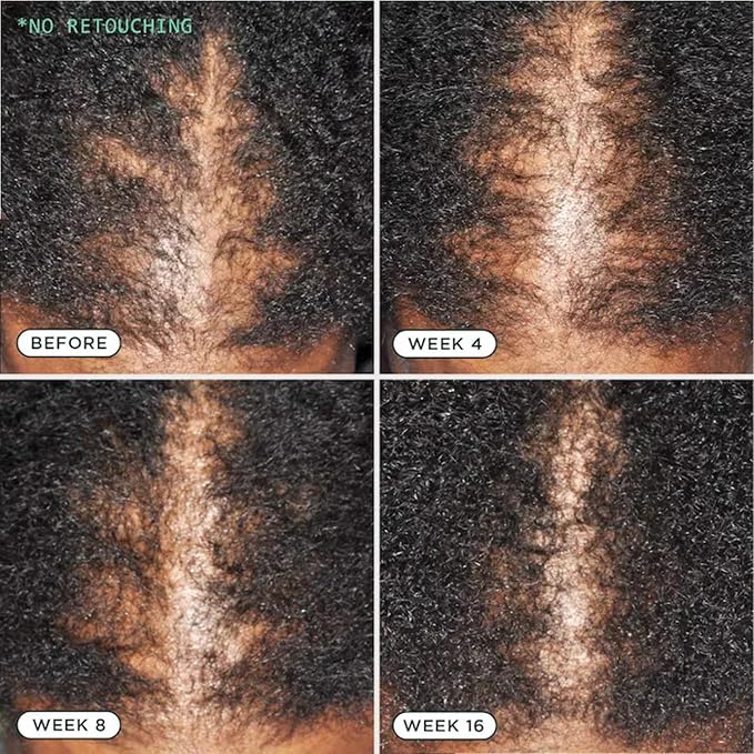 Sienna Naturals - D.N.A. Scalp Serum – Hair Growth Serum for Thinning Hair, Scalp Repair & Strength – Nourishing, Active Treatment for Scalp Health with Biotin & Rosemary– 1 oz