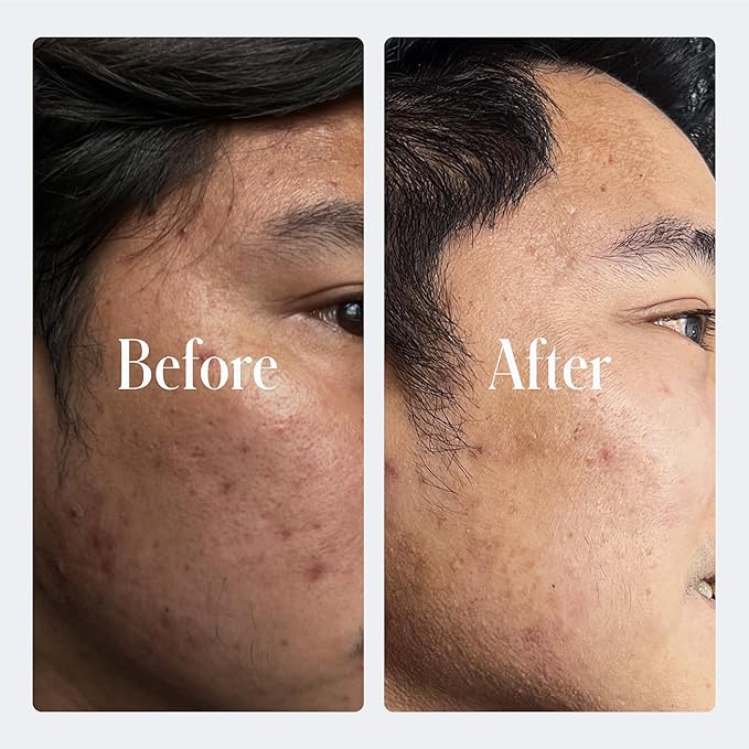 Geologie Retinol Anti-Aging Face Cream | Enhanced .2% Retinol Formula for Effective Results | Reduce Fine Lines & Wrinkles | Protect & Repair Skin With Hyaluronic Acid & Niacinamide | For Men & Women