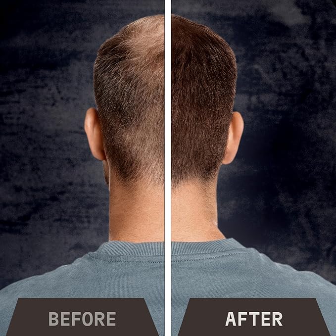 Striking Viking Hair Fibers for Thinning Hair (Medium Brown) 28g - Naturally Derived - Long Lasting Powder, Undetectable, Thicker Look for Men & Women