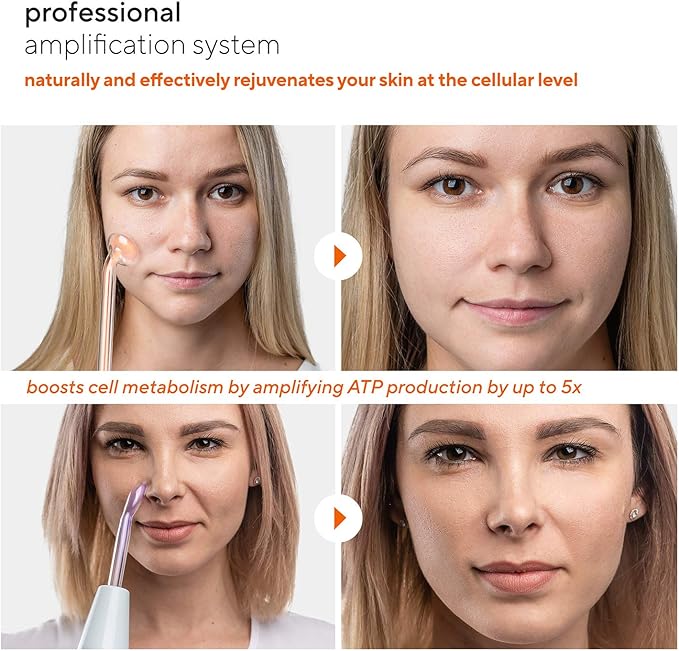 NuDerma Professional Skin Therapy Wand - Portable Skin Therapy Machine with 6 Neon & Argon Wands – Boost Your Skin – Clear Firm & Tighten