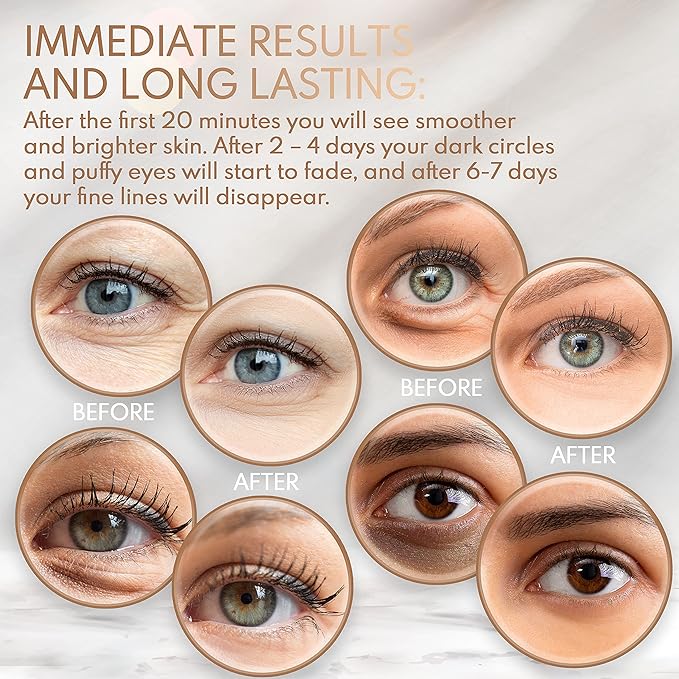 Under Eye Anti-Aging Eye Mask Collagen Patch Treatment for Minimizing Wrinkles, Puffy Eyes, Eye Bags, Dark Circles, Fine Lines Under the Eye, Looking Less Tired, Revitalizing, Moisturizing and