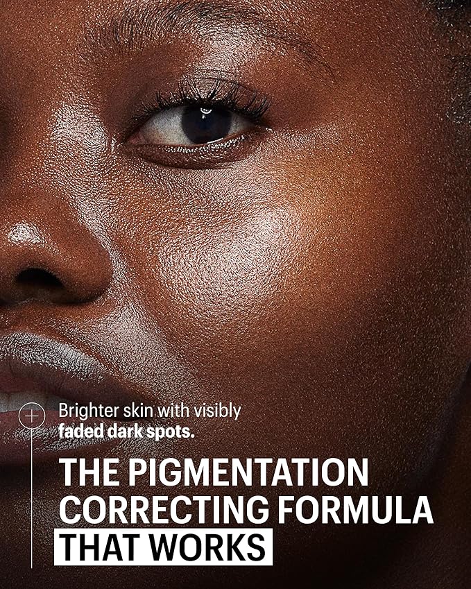 Allies of Skin Mandelic Pigmentation Corrector Night Serum | Gentle Acne Face Serum with Bakuchiol, Niacinamide & Salicylic Acid | Anti-Aging Formula to Reduce Pores and Even Skin Tone (1 oz)